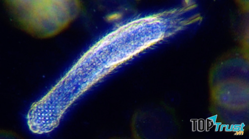 Vi sinh vật Gastrotricha