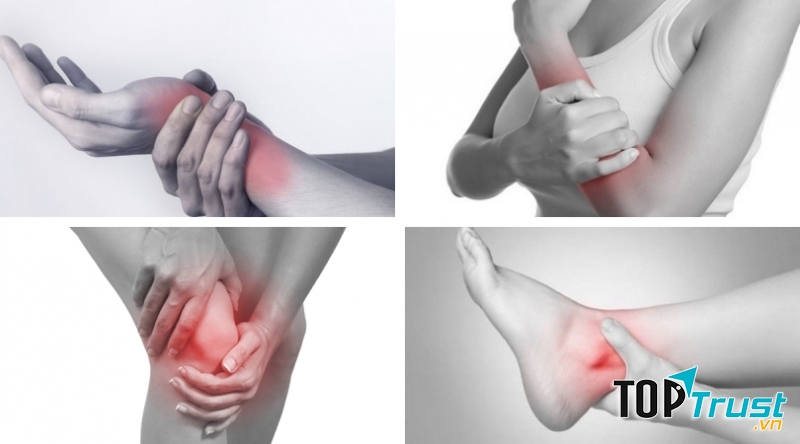 Bệnh viêm khớp thường gặp vào mùa đông