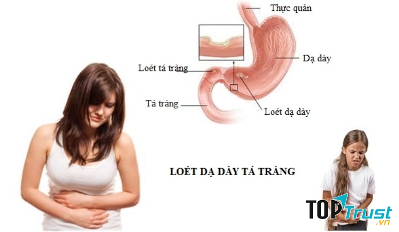 Ảnh minh họa (Nguồn Internet)