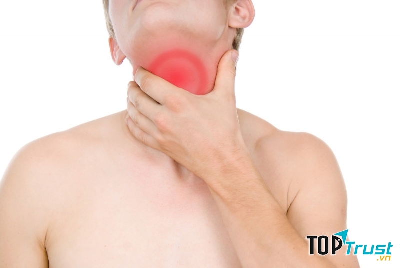 Viêm loét thực quản