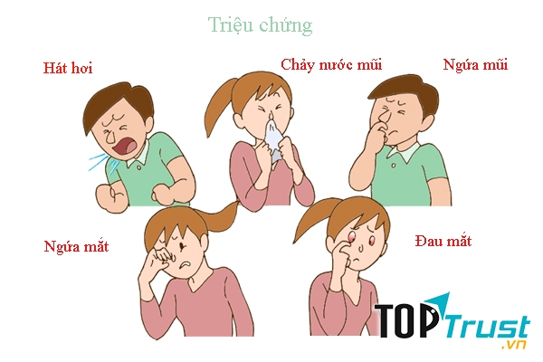 Các triệu chứng của bệnh viêm mũi dị ứng