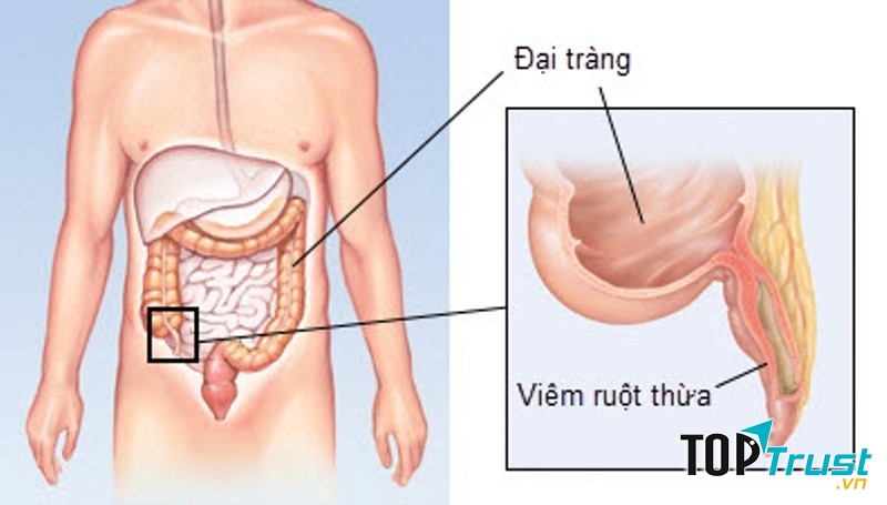 Ảnh minh họa (Nguồn Internet)