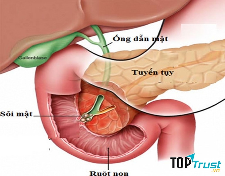 Ảnh minh họa (Nguồn Internet)
