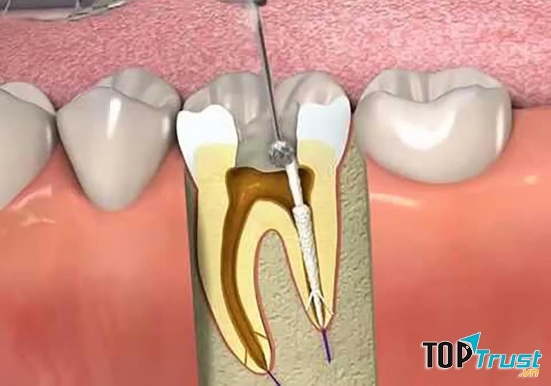 Ảnh minh họa (Nguồn Internet)