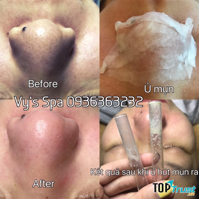 Viện chăm sóc da Vy’s Beauty Clinic