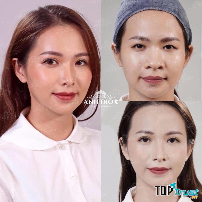 Viện Thẩm Mỹ ADC - AnhDior Beauty