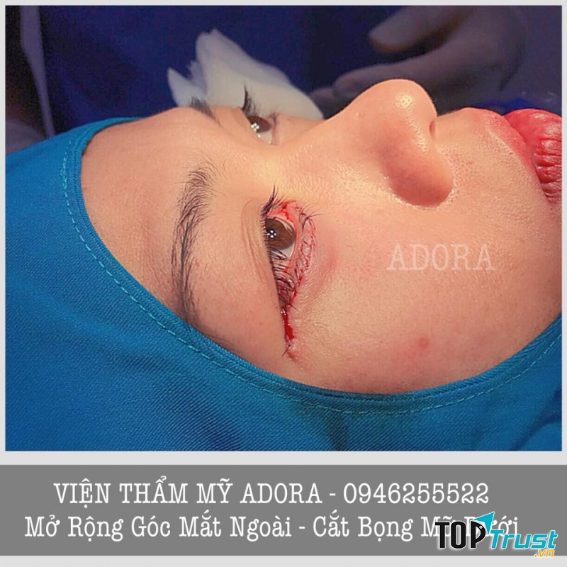 Viện Thẩm Mỹ ADORA