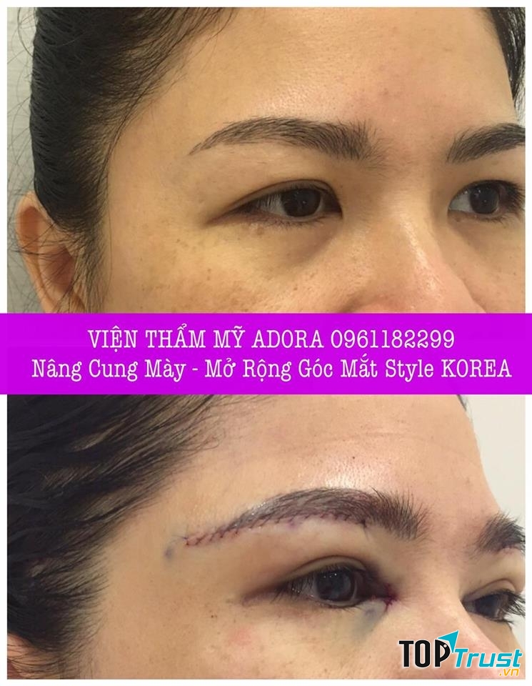 Viện Thẩm Mỹ ADORA