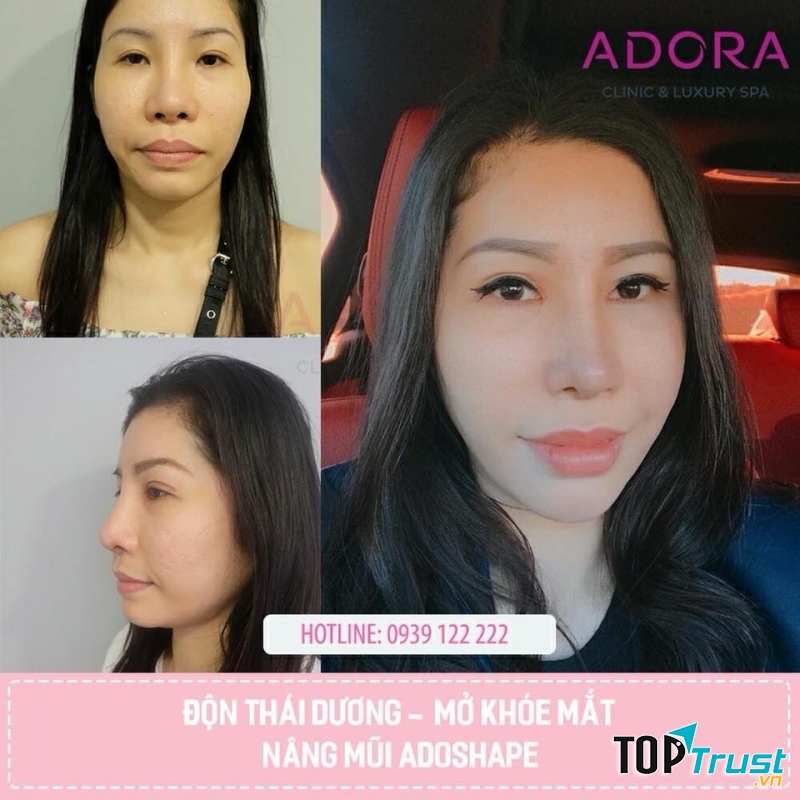 Viện Thẩm Mỹ ADORA