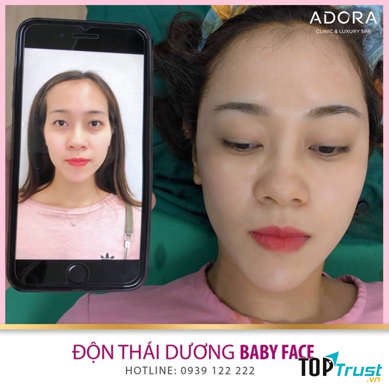 Viện Thẩm Mỹ ADORA