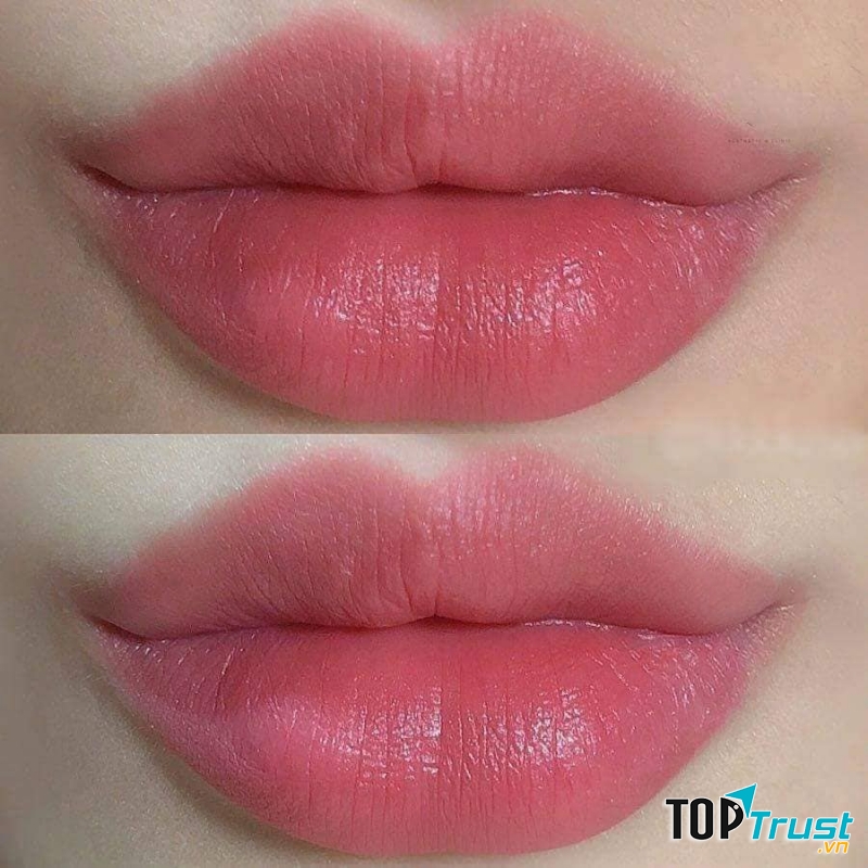 Viện Thẩm Mỹ Công Nghệ Cao ELISA