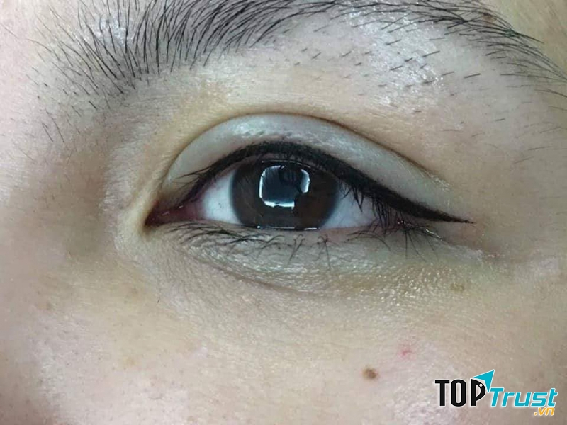 Viện Thẩm Mỹ Công Nghệ Cao ELISA