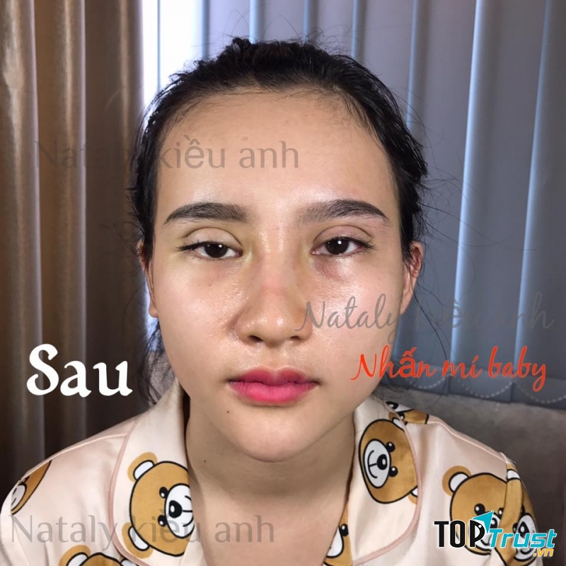 Viện Thẩm Mỹ Công Nghệ Cao Nataly