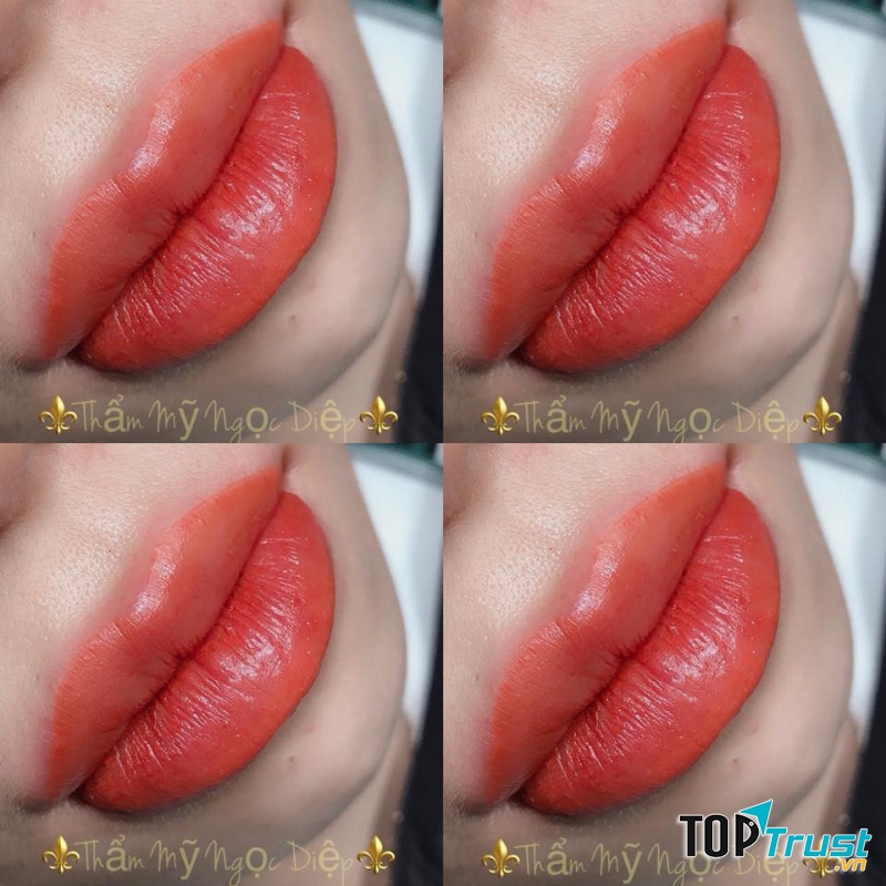 Viện Thẩm Mỹ Công Nghệ Cao - Ngọc Diệp