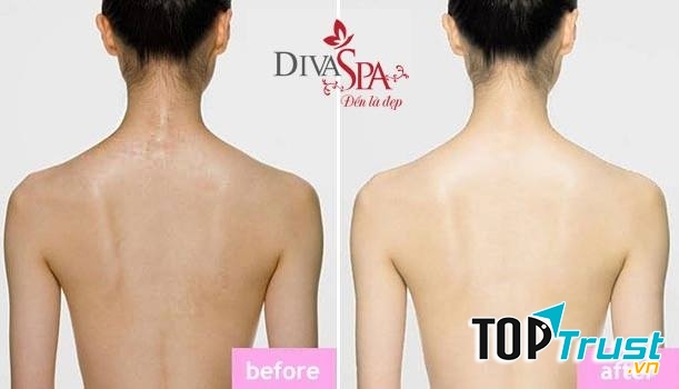 Viện Thẩm Mỹ DIVA