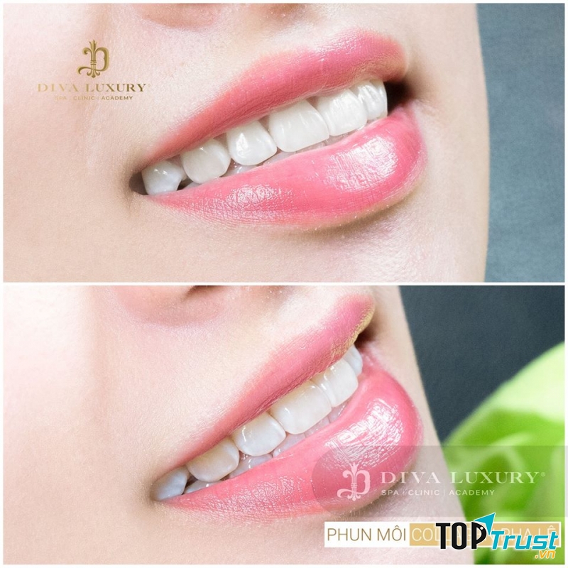 Viện Thẩm Mỹ DIVA