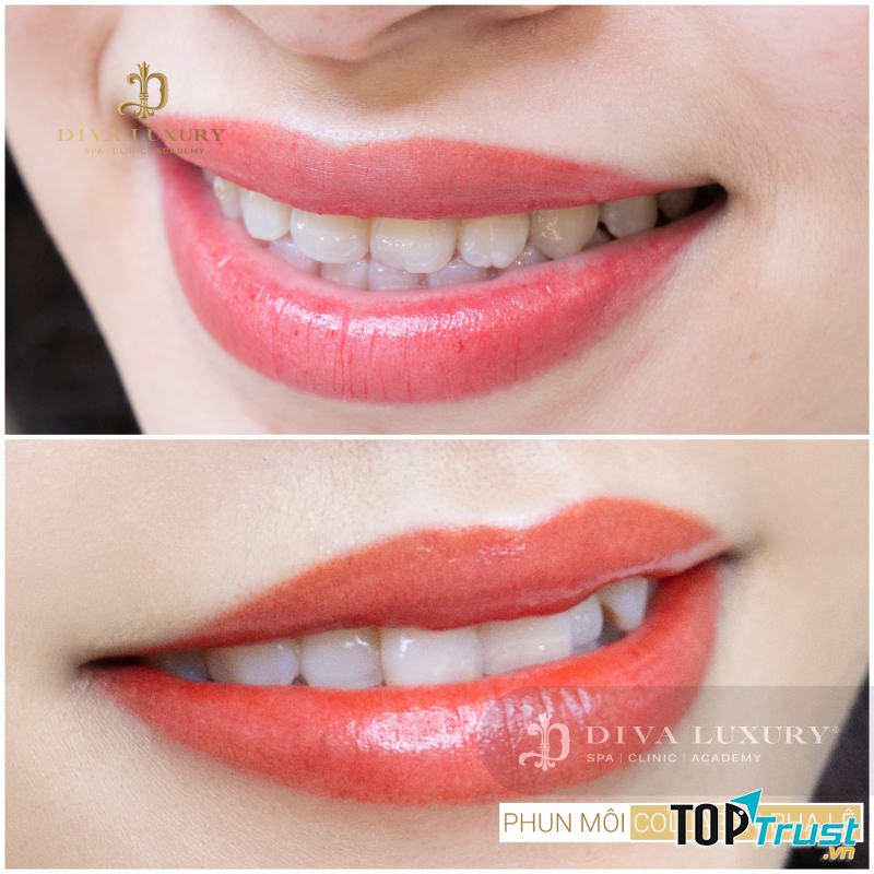 Viện Thẩm Mỹ DIVA