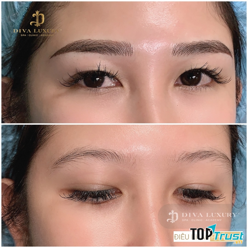 Viện Thẩm Mỹ DIVA