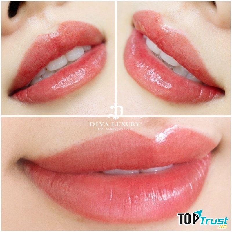 Viện Thẩm Mỹ DIVA - Đà Lạt Lâm Đồng