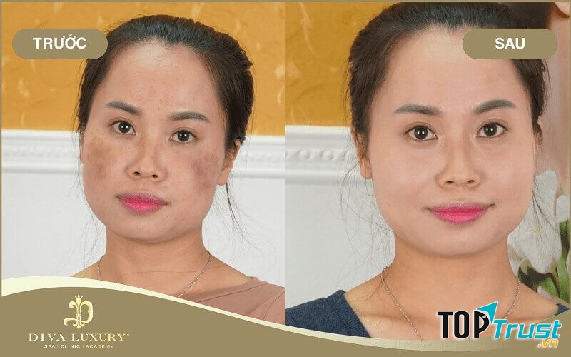 Viện Thẩm Mỹ DIVA - Đà Nẵng