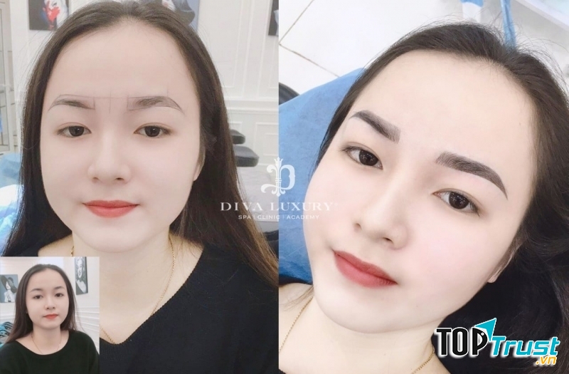 Viện Thẩm Mỹ DIVA