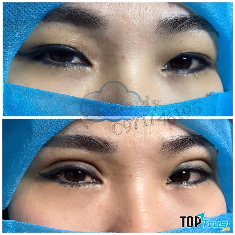 Viện Thẩm Mỹ Hải Vân