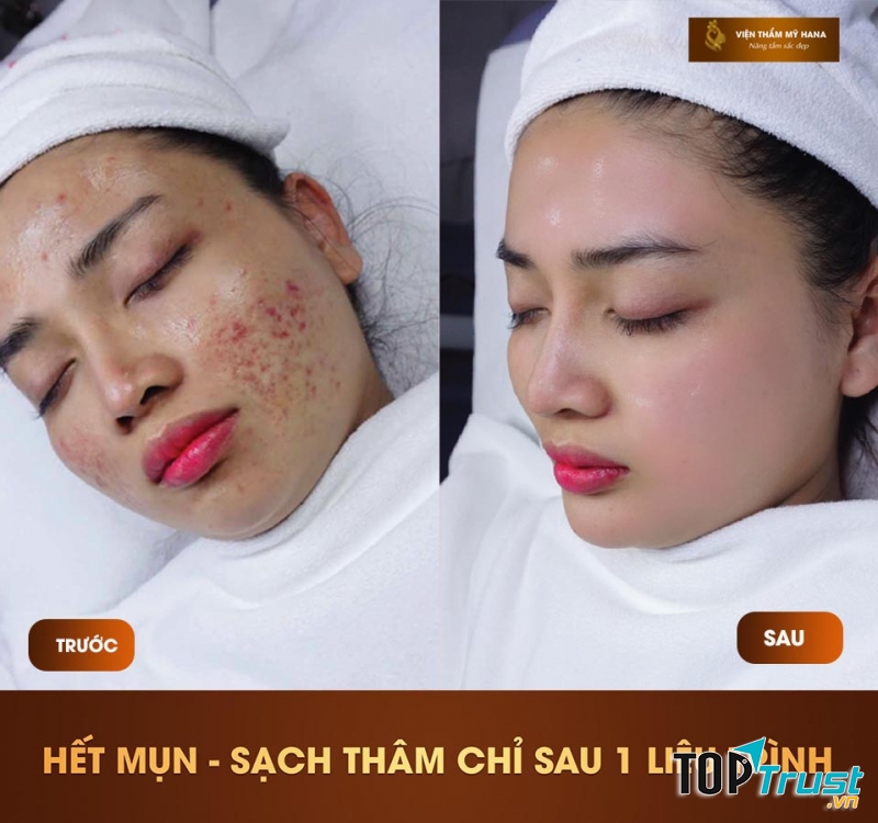 Viện Thẩm Mỹ Hana