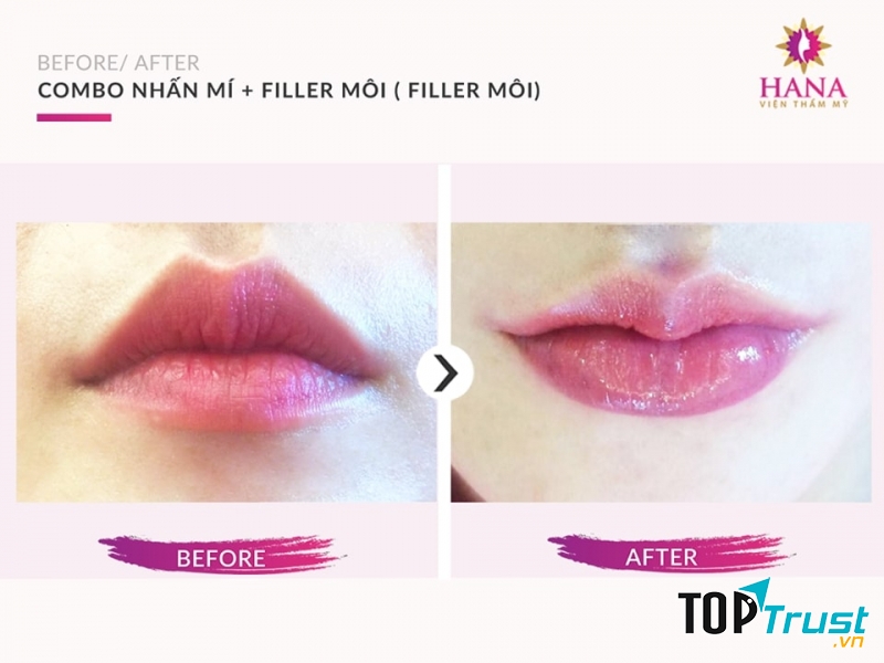 Viện thẩm mỹ Hana Vũng Tàu