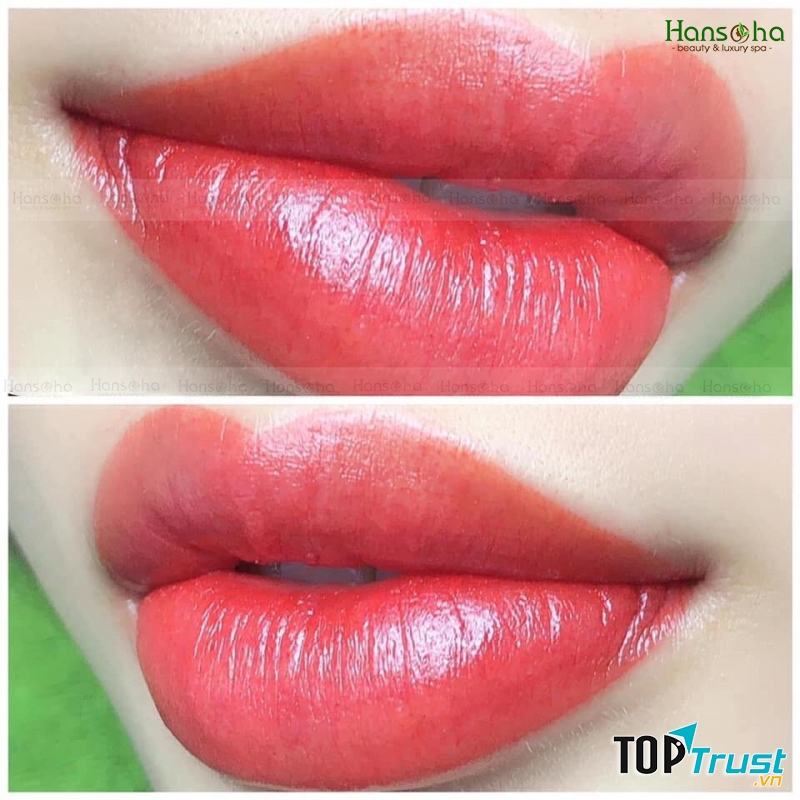 Viện Thẩm Mỹ Hansoha