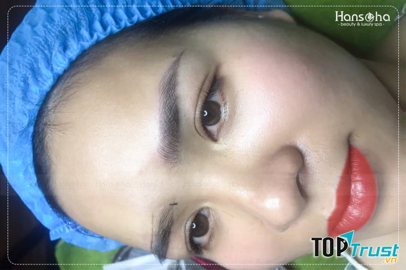 Viện Thẩm Mỹ Hansoha