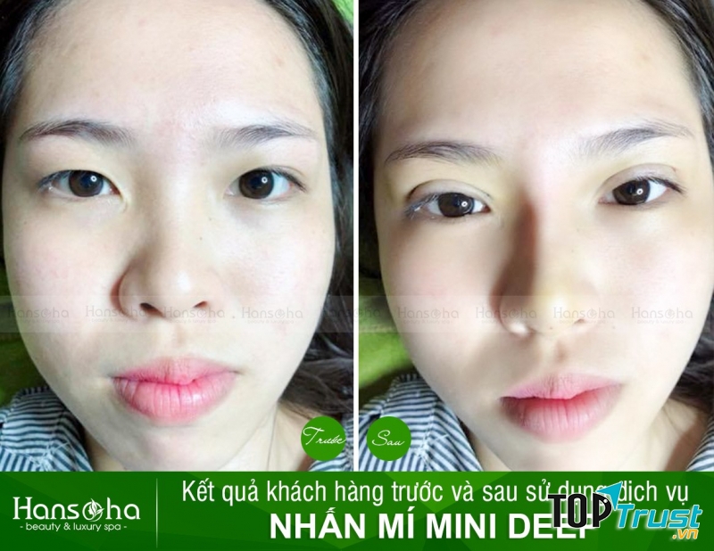 Viện Thẩm Mỹ Hansoha