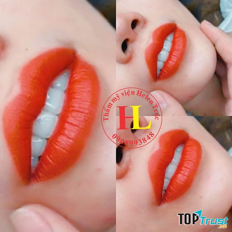 Viện Thẩm mỹ Helen Truc Beauty