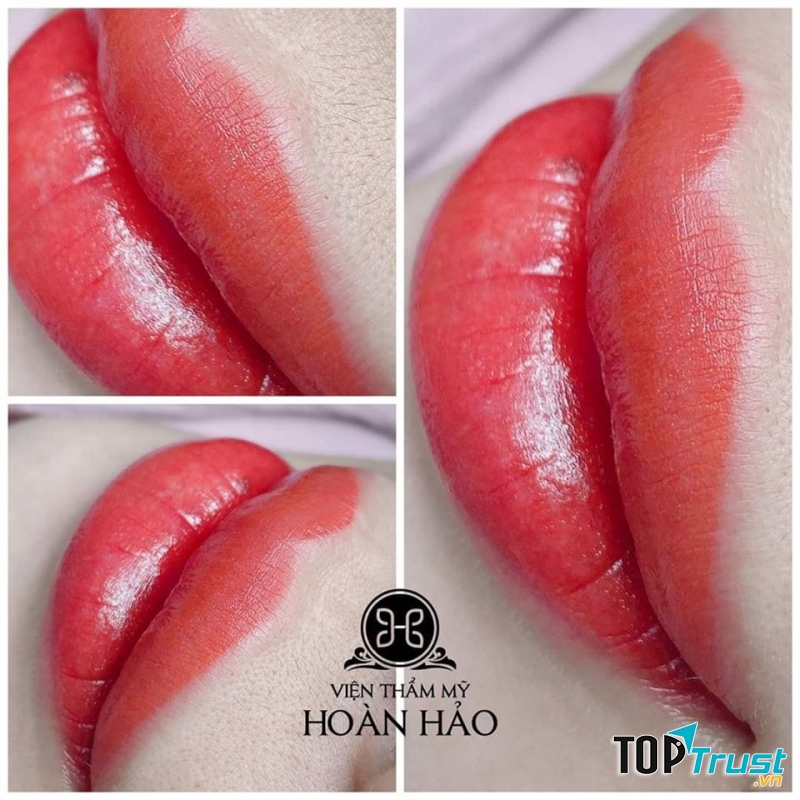 Viện Thẩm Mỹ Hoàn Hảo