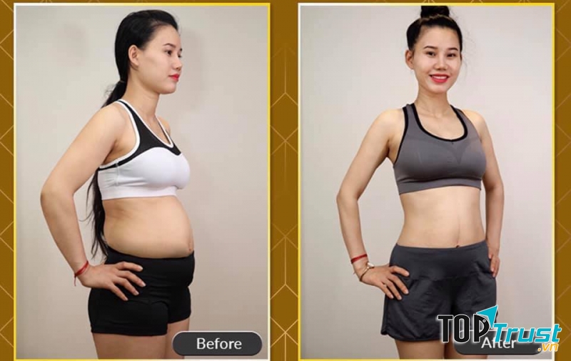 Viện Thẩm Mỹ Kim Cơ Sở 3 Yên Bái