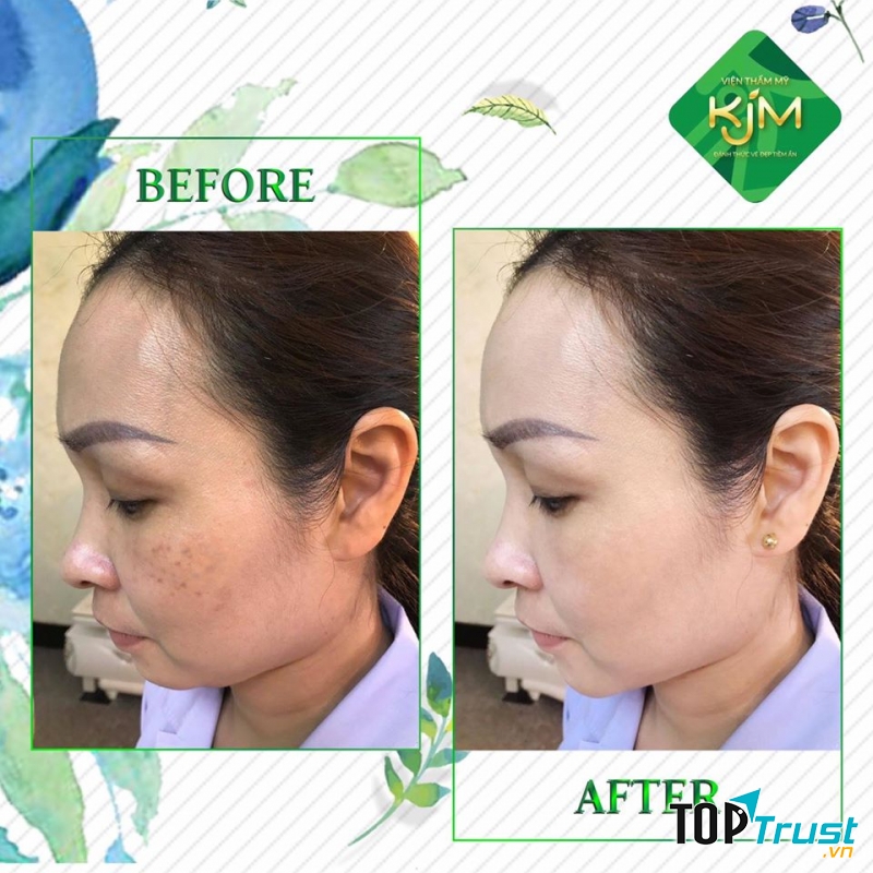 Viện Thẩm Mỹ KJM
