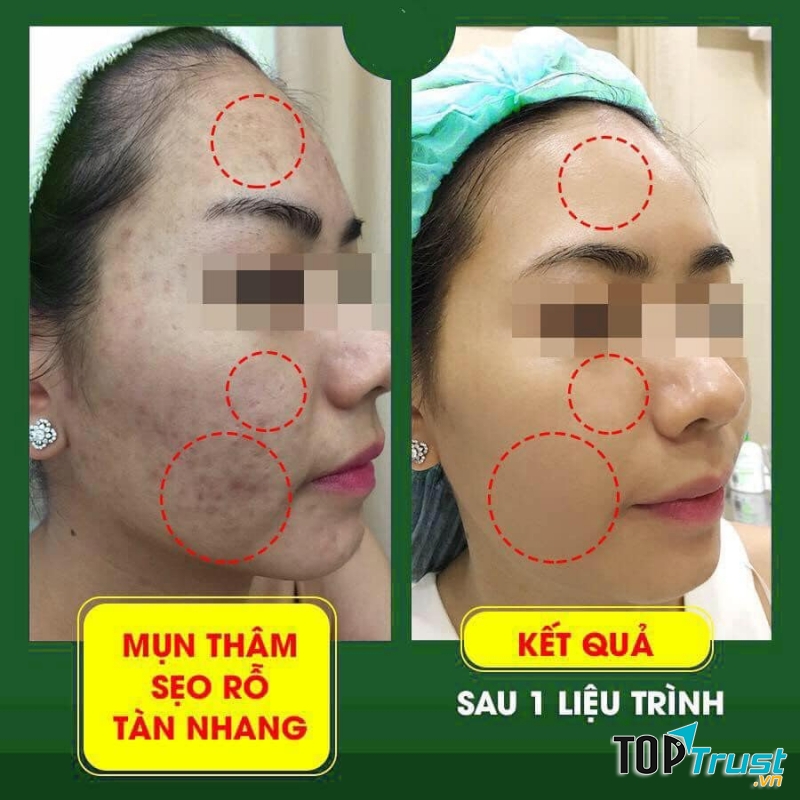 Viện Thẩm Mỹ Korea