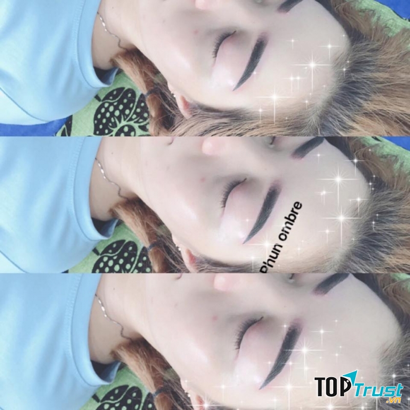 Viện thẩm mỹ - Lâm Phong Natural