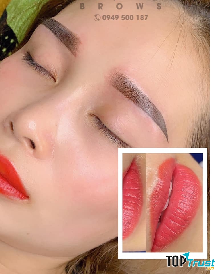 Viện thẩm mỹ - Lâm Phong Natural