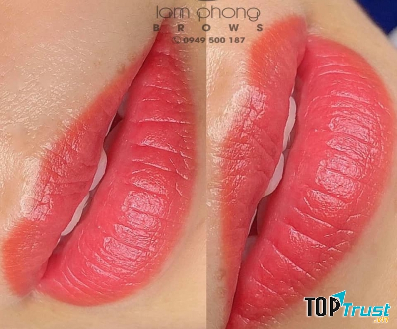 Viện thẩm mỹ - Lâm Phong Natural