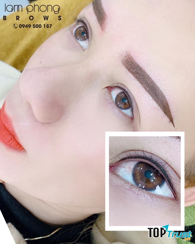 Viện thẩm mỹ - Lâm Phong Natural