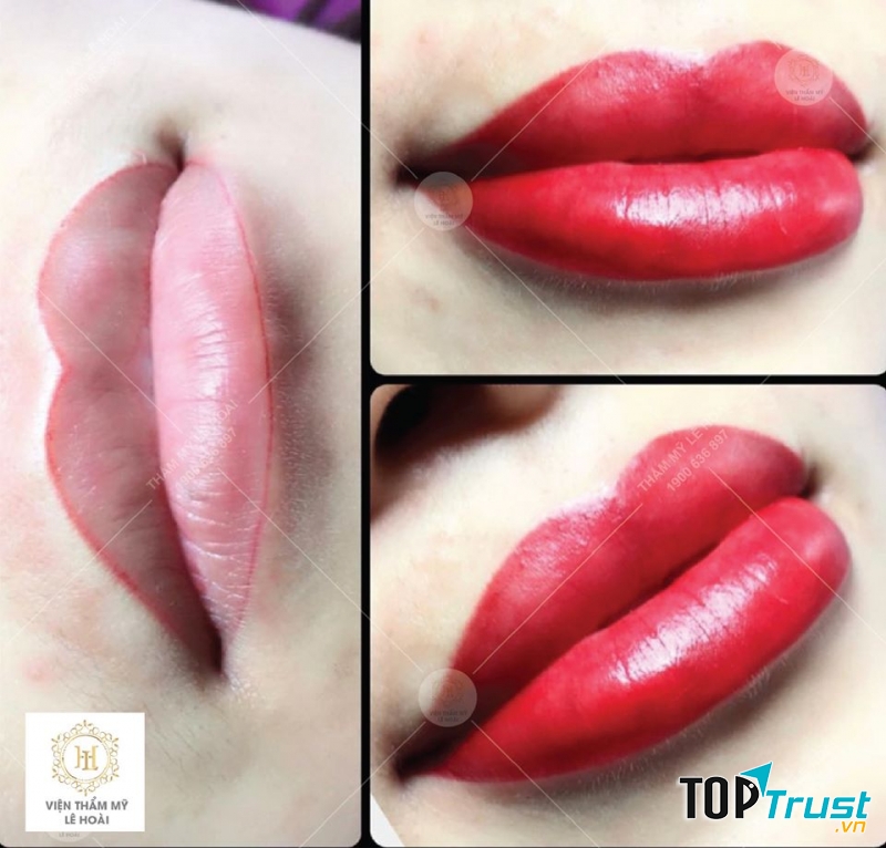 Viện thẩm mỹ Lê Hoài