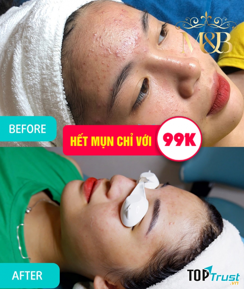 Viện Thẩm Mỹ MB - Ninh Bình
