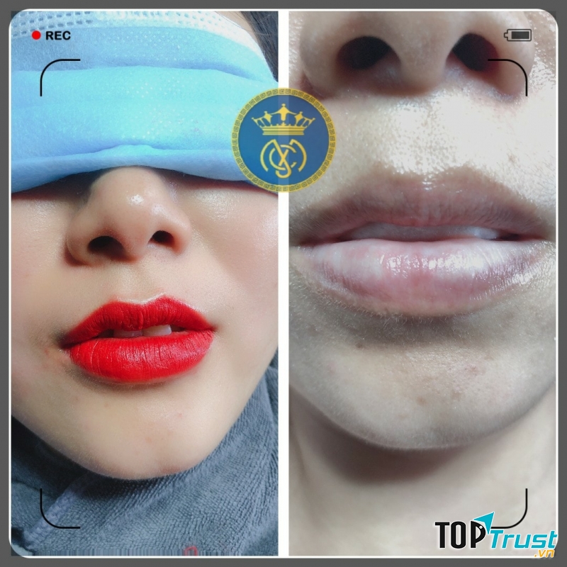 Viện Thẩm Mỹ MC