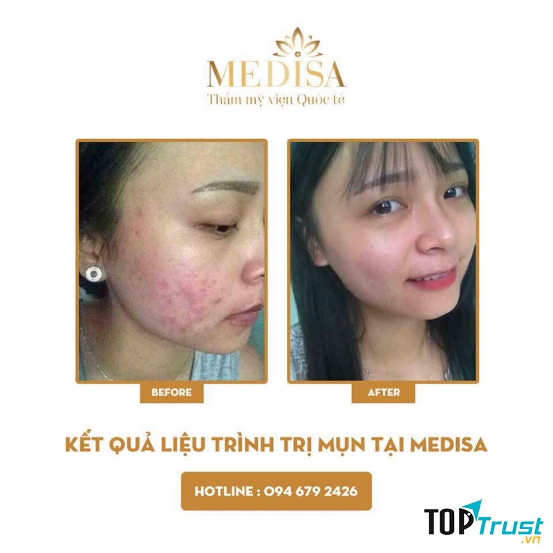 Viện Thẩm Mỹ Medisa