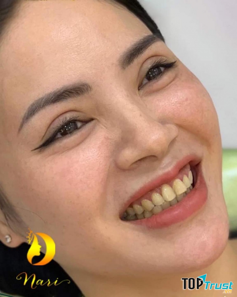 Viện Thẩm Mỹ Nari