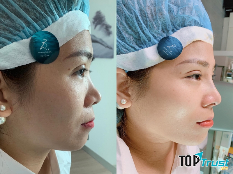Viện Thẩm Mỹ Phương Anh