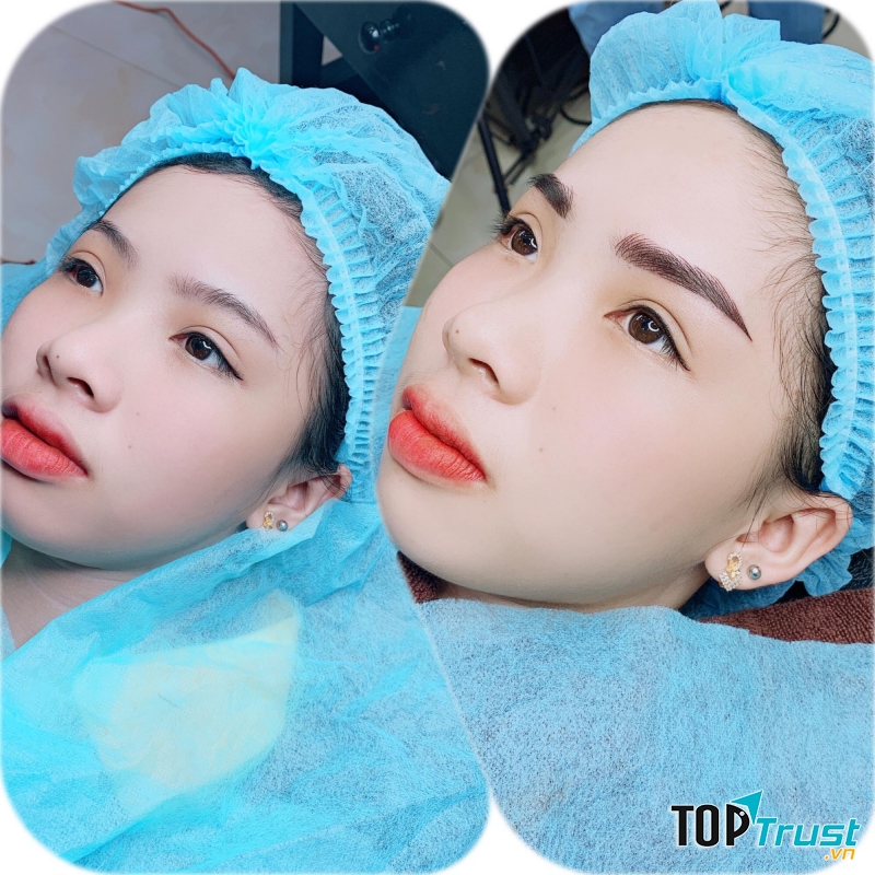 Viện Thẩm Mỹ Quốc Tế Eva Xinh Ninh Bình