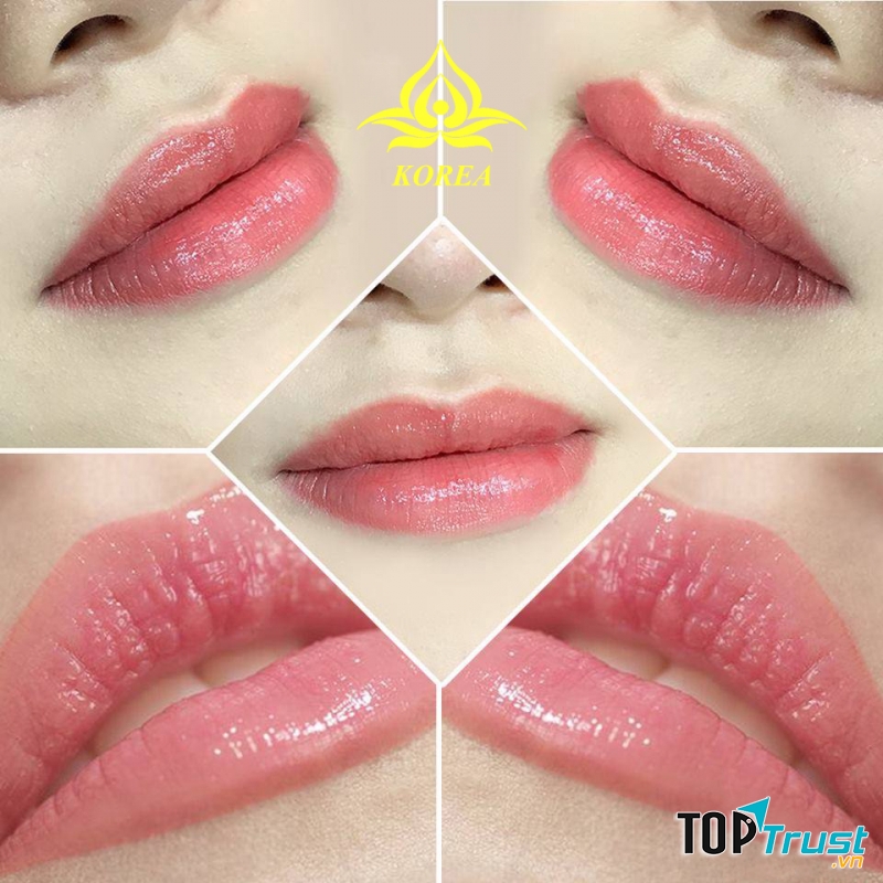 Viện Thẩm Mỹ Quốc Tế KOREA