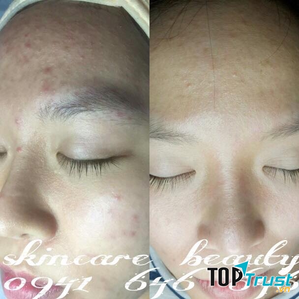 Viện Thẩm Mỹ Quốc Tế KT QUEEN - Phú Quốc