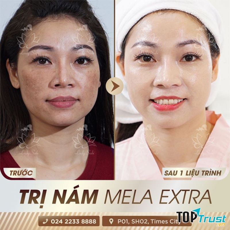 Viện Thẩm Mỹ Quốc Tế Lady Sabi